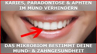 Karies Paradontose amp Aphten entstehen im MIKROBIOM  Zahngesundheit dauerhaft verbessern [upl. by Mcwherter227]