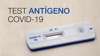 Test Antígeno COVID19 Clínica CEMTRO [upl. by Maclaine]