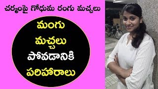 Mangu machalu home remedies in TeluguDark Skin PatchesHyperpigmentation remedies at homeBeautyTip [upl. by Randene]