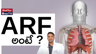 What is Acute Respiratory Failure   ARF Symptoms  DrRaja Manohar Acharyulu MedPlusONETV [upl. by Bronez]