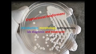 Cryptococcus neoformans Introduction morphology pathogenesis lab diagnosis and treatment [upl. by Khano44]