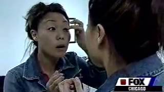 Asian Double Eyelid Surgery Fox News [upl. by Norret914]