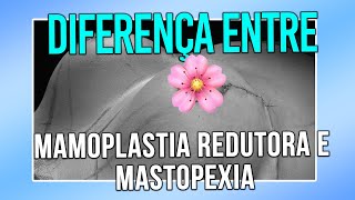 DIFERENÇA ENTRE MAMOPLASTIA REDUTORA E MASTOPEXIA  CIRURGIA PLÁSTICA [upl. by Ahsem]