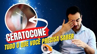 CERATOCONE  TUDO O QUE VOCÊ PRECISA SABER [upl. by Villada]