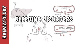 Approach to bleeding disorders  causes pathophysiology and investigations [upl. by Lucille]