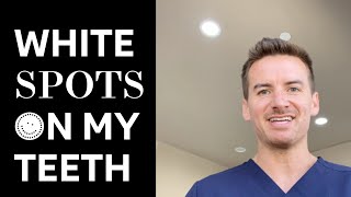 Ask Dr Shaun What are these white spots on my teeth [upl. by Asenej]