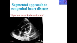 Segmental approach in congenital heart diseases echocardiogram [upl. by Onfre]