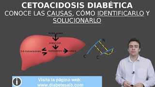 Cetoacidosis diabética definición síntomas causas diagnóstico y solución  Diabetes AIB [upl. by Marb]