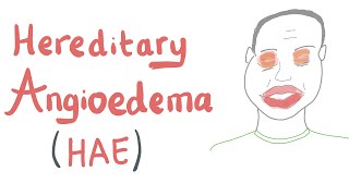 Hereditary Angioedema HAE [upl. by Atahs]