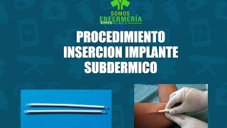 Procedimiento Insercion de implante subdermico Jadell [upl. by Crescen505]