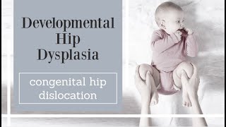 Developmental Hip Dysplasia  congenital hip dislocation [upl. by Nabalas745]