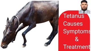 TetanusCauses SymptomsTreatment amp prevention  Dr M Sattar Ahmed Rajpoot [upl. by Muire]