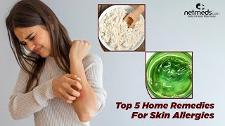 5 Best Natural Remedies For Skin Allergies [upl. by Oconnor]