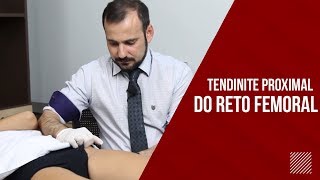 Tendinite Reto Femoral CUIDADO COM A ARTÉRIA [upl. by Faus]