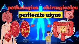 cours S3  Pathologies Chirurgicales et SI  Péritonite aigue 💊🩺💉🩸 شرح سهل 📚و 📚 مبسط للفهم [upl. by Mathilde]