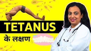 Tetanus Symptoms  Tetanus Ke Lakshan Kya Hote Hai [upl. by Aisatana550]