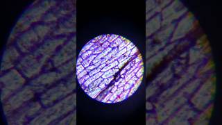 Onion skin and onion cells under a microscope [upl. by Gerianne]