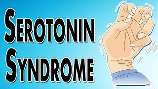 Managing Serotonin Syndrome [upl. by Isidro977]