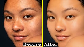 Acne spot remove photo retouching । Face smooth in photoshop । clean face in photoshop [upl. by Chicoine254]