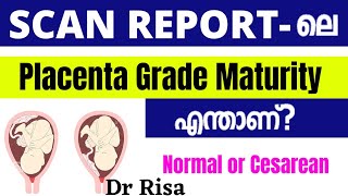 Placenta Grade in Scan Report Malayalam  Placenta Position [upl. by Thaxter979]