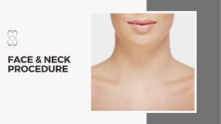 Face amp Neck Procedures [upl. by Irehs]