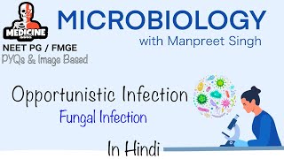 Microbiology 27  Opportunistic Fungal Infections Microbiologywith Manpreet Singh’s Medicine Addict [upl. by Esenwahs]