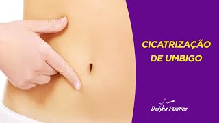 CICATRIZAÇÃO DE UMBIGO APÓS ABDOMINOPLASTIA [upl. by Auhsuoj]