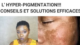 PEAU NOIRE MATURE ET HYPERPIGMENTATION [upl. by Nahbois]