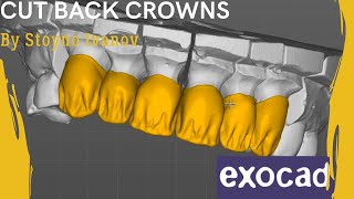 Fastest Exocad Video Tutorial  How To Design Cutback Crowns For Layering [upl. by Noreht]