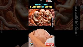 Triple the joy  Tiny little miracles growing together baby blessings pregnancy shortsfeed [upl. by Wagshul]