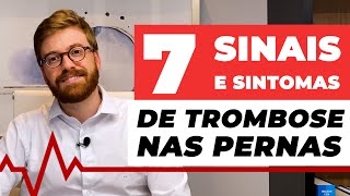 7 SINAIS E SINTOMAS DE TROMBOSE NAS PERNAS [upl. by Eahsram]