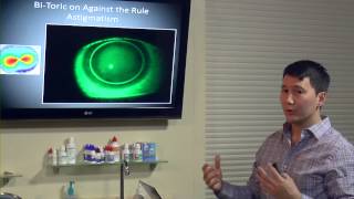 Corneal Topography amp Specialty Contact Lenses  Randy Kojima [upl. by Ahseyi]