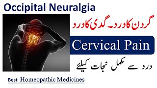 Occipital Neuralgia  گردن کا درد ، گدی کا درد  Best Homeopathic Medicines for Cervical Pain [upl. by Sonaj]