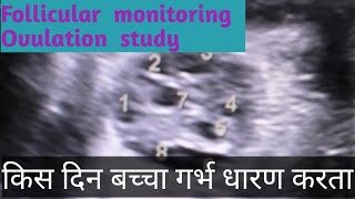 Follicular monitoring Ovulation study FollicleDoctor home [upl. by Novaelc97]