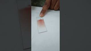 Making a peripheral blood smear  blood smear preparation  prepare a perfect blood smearHematology [upl. by Nyleimaj]