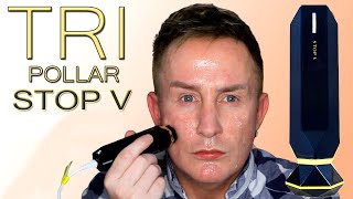 TriPollar Stop V Before amp After  Radiofrequency amp DMA Skin Tightening [upl. by Stodder796]