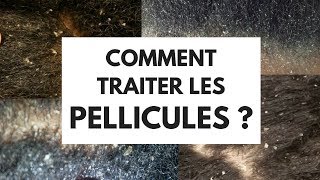 COMMENT TRAITER LES PELLICULES [upl. by Elehcir614]