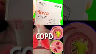 youtubeshorts healthylifestyle medicine  Tiotropium bromide Inhaler 9 mcg Uses in Hindi  tiova [upl. by Polik]