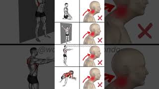 Correct Forward Head Posture Effective Exercises and Tips for Instant Relief [upl. by Daiz]