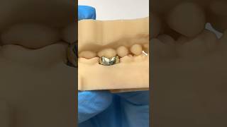 Gold Occlusion EnvisiontecMain envisiontec lsk121shorts teeth dentist [upl. by Aneek]