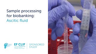 Sample processing for biobanking Ascitic fluid [upl. by Akkeber]