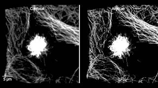 ZEISS LSM 880 Mitosis in tumor cells with Airyscan SR mode [upl. by Ledah181]