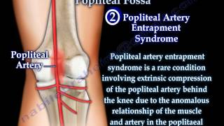 Anatomy Of The Popliteal Fossa  Everything You Need To Know  Dr Nabil Ebraheim [upl. by Bondie]