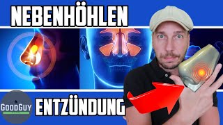 Nebenhöhlenentzündung was hilft wirklichAnatomieUrsachen 4 wichtige Vitalstoffe die du brauchst [upl. by Oesile125]