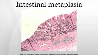 Intestinal metaplasia [upl. by Jahdai]