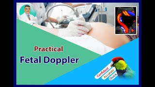 Practical Obstetric Doppler  Umbilical Artery Doppler [upl. by Ardnoet]