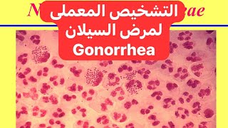 التشخيص المعملى لمرض السيلان Lab Diagnosis of Gonorrhea [upl. by Haydon324]