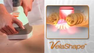 VelaShape  video ENG [upl. by Varden608]