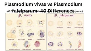 Plasmodium vivax vs Plasmodium falciparum 40 Differences [upl. by Kissee397]