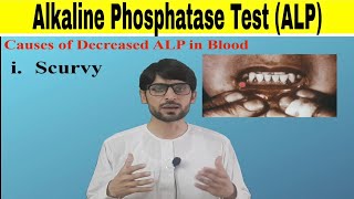 Alkaline Phosphatase Test ALP [upl. by Amby]